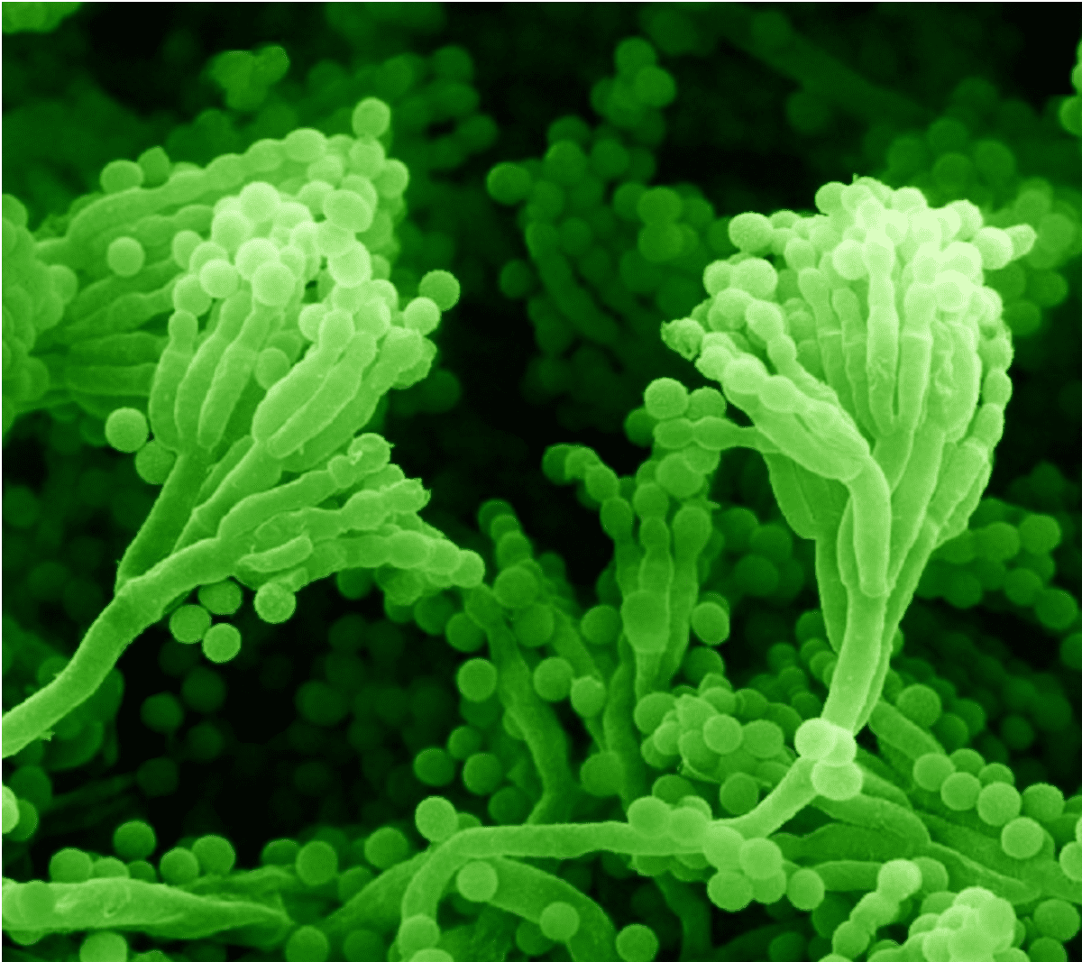 Bacterial Infections